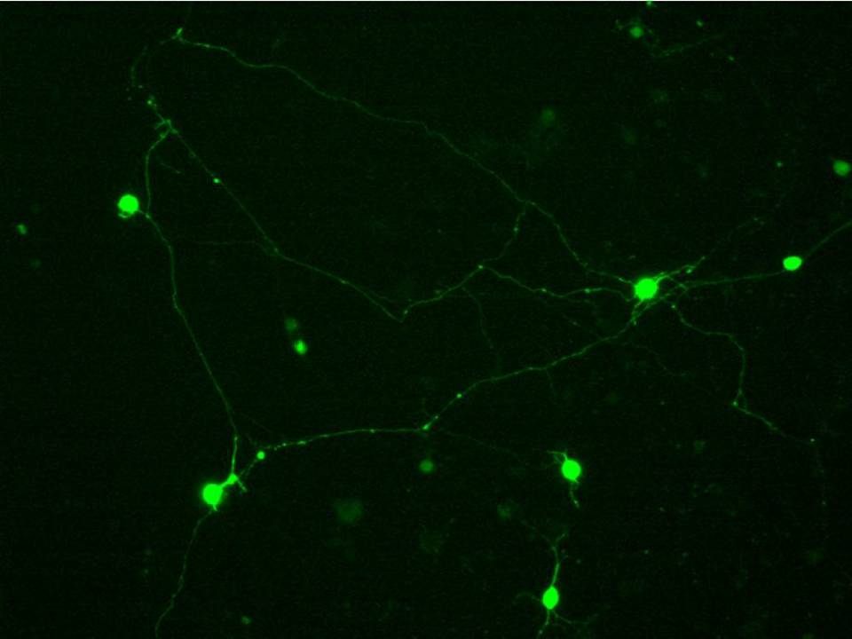 Primary Rat Neurons in Adherence - 48 hrs post EP - Transfection Efficiency 50 per cent